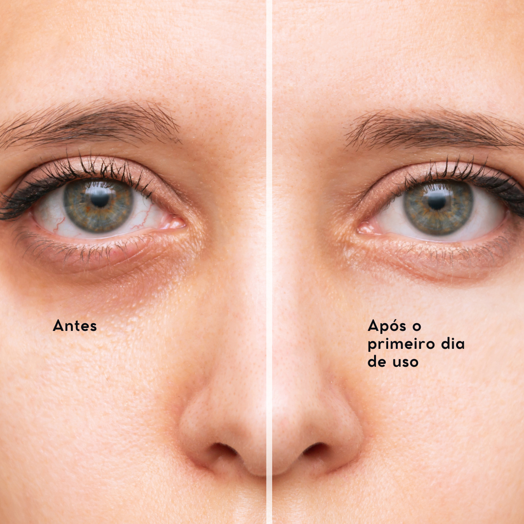 Creme Para Área Dos Olhos - 4 em 1 - Sérum CutesyCare